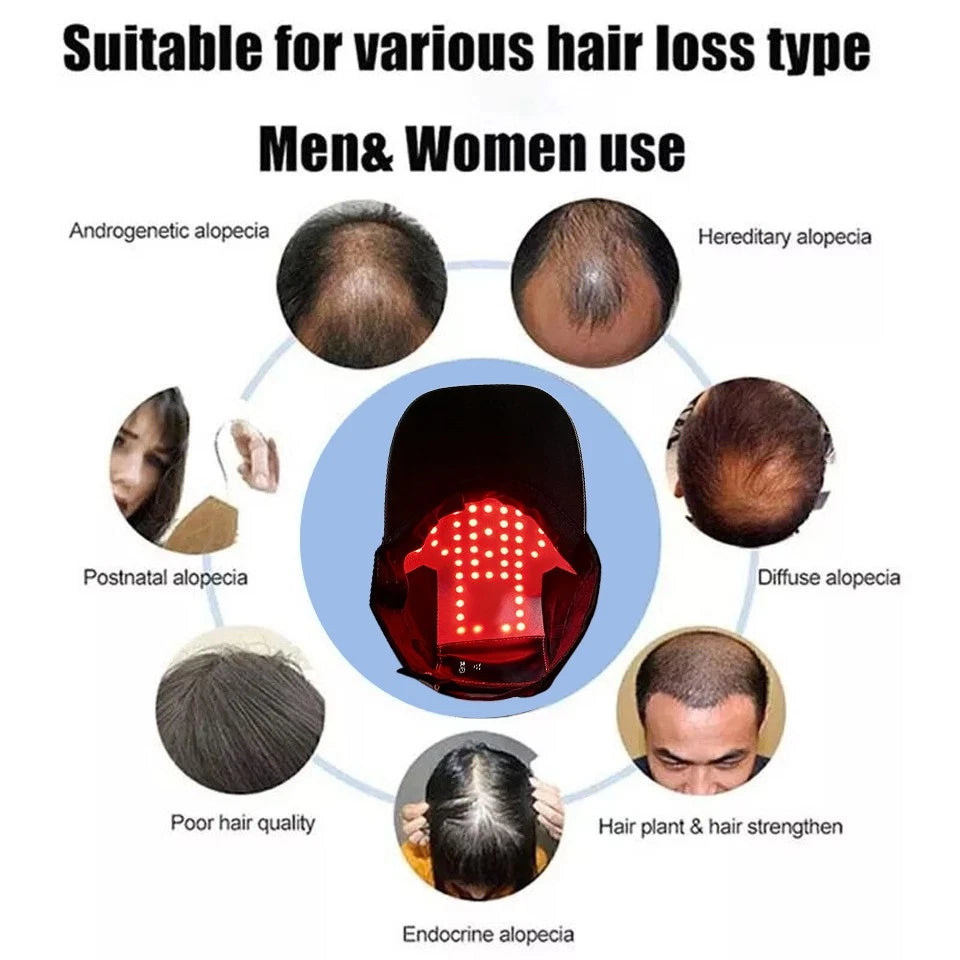 Home Of Tech Essentials red light therapy cap for hair regrowth, showing the black cap with red light panels on a white background.